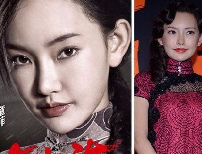 童菲整容前后，童菲(演员菲菲整容)