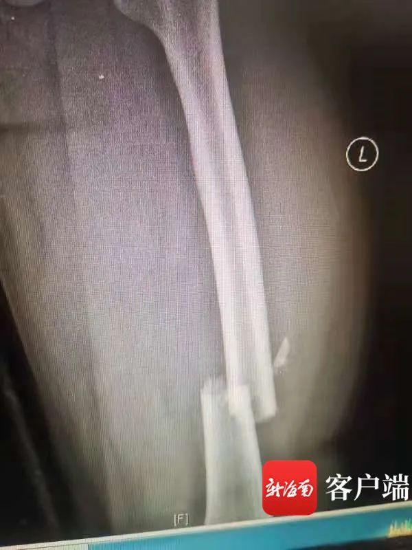 海口世纪大桥车祸最新消息（海口世纪大桥5车连环撞后续）(2)