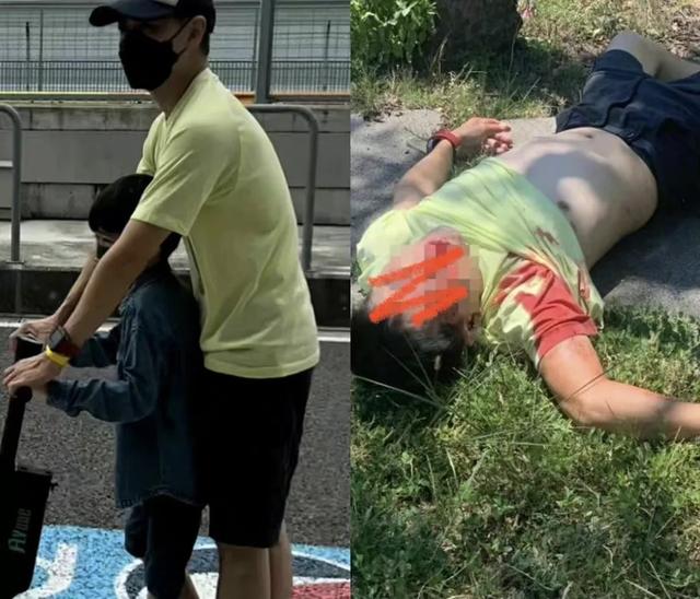 林志颖车祸事件分析（林志颖满脸是血）(9)