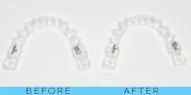 整容后变好看的五位女明星(那些默默变美的明星们不是整容)(33)