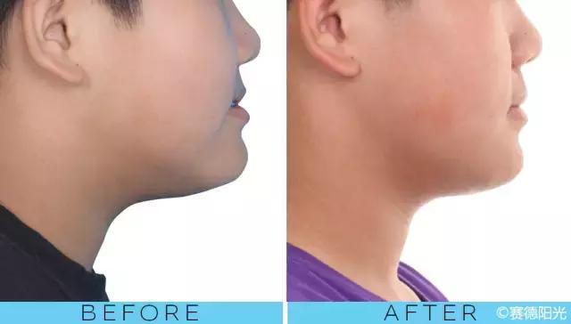 整容后变好看的五位女明星(那些默默变美的明星们不是整容)(18)