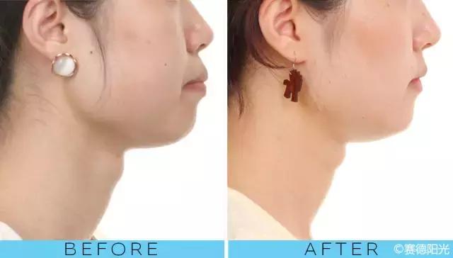 整容后变好看的五位女明星(那些默默变美的明星们不是整容)(17)