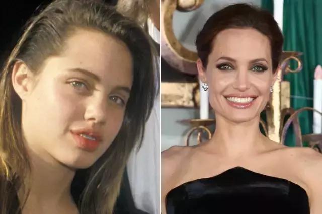 整容后变好看的五位女明星(那些默默变美的明星们不是整容)(10)