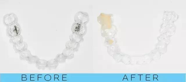 整容后变好看的五位女明星(那些默默变美的明星们不是整容)(35)