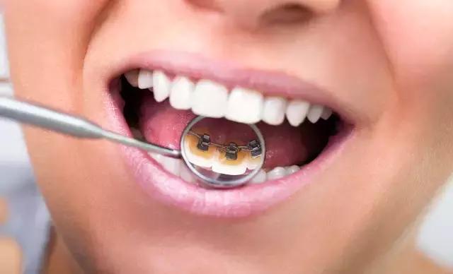 整容后变好看的五位女明星(那些默默变美的明星们不是整容)(24)