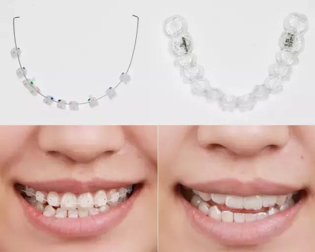 整容后变好看的五位女明星(那些默默变美的明星们不是整容)(27)