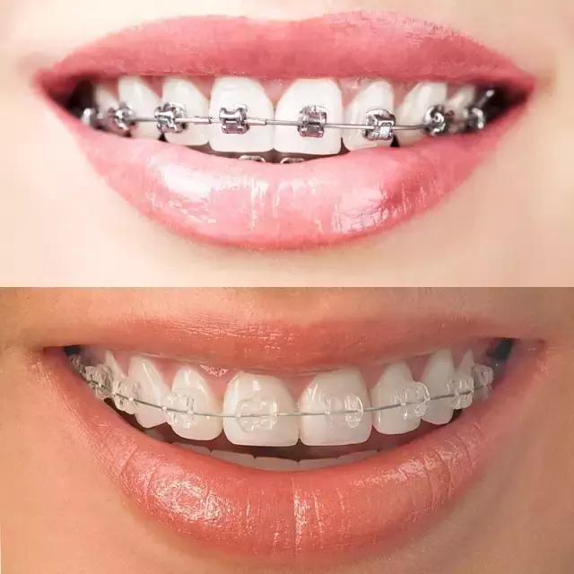 整容后变好看的五位女明星(那些默默变美的明星们不是整容)(23)