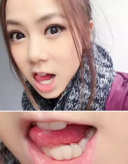 整容后变好看的五位女明星(那些默默变美的明星们不是整容)(3)