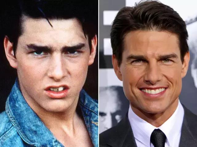 整容后变好看的五位女明星(那些默默变美的明星们不是整容)(11)