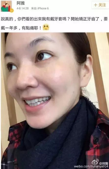 整容后变好看的五位女明星(那些默默变美的明星们不是整容)(4)