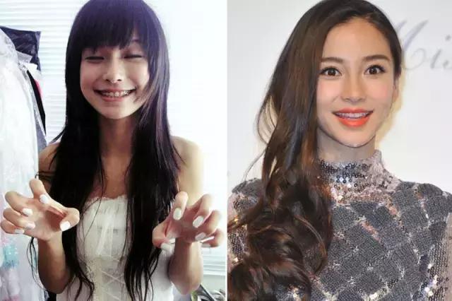 整容后变好看的五位女明星(那些默默变美的明星们不是整容)(15)