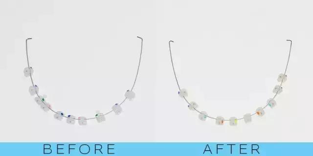 整容后变好看的五位女明星(那些默默变美的明星们不是整容)(31)