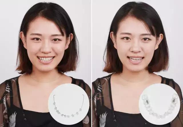 整容后变好看的五位女明星(那些默默变美的明星们不是整容)(26)