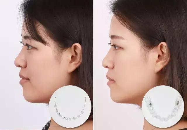 整容后变好看的五位女明星(那些默默变美的明星们不是整容)(28)