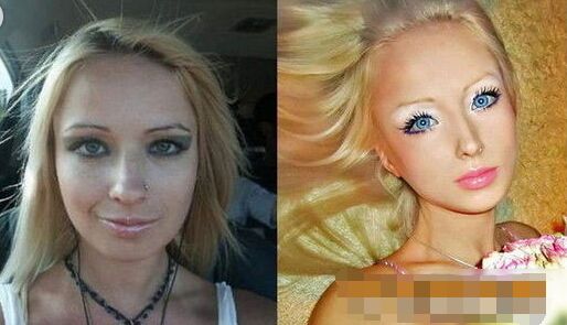 乌克兰瓦莱里娅·露可安诺娃真人芭比娃娃整容前后照片对比