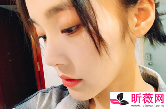 张佳宁个人资料简介:张佳宁八卦家庭背景起底