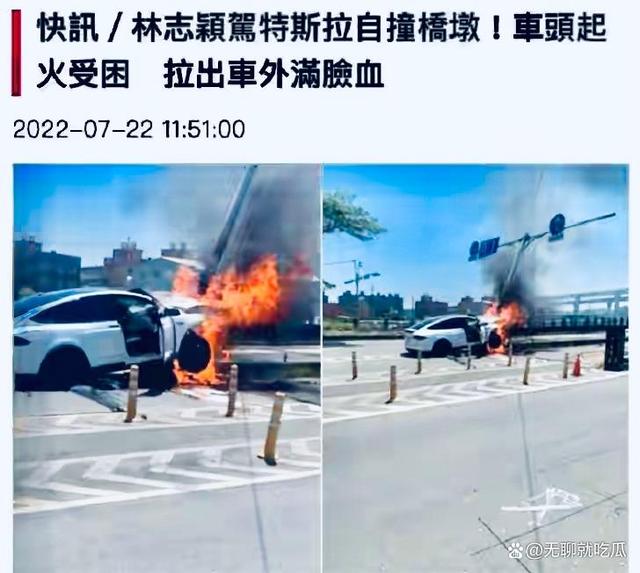 林志颖突发车祸!面部、肩膀骨折需要手术,整形医师也要参与手术-