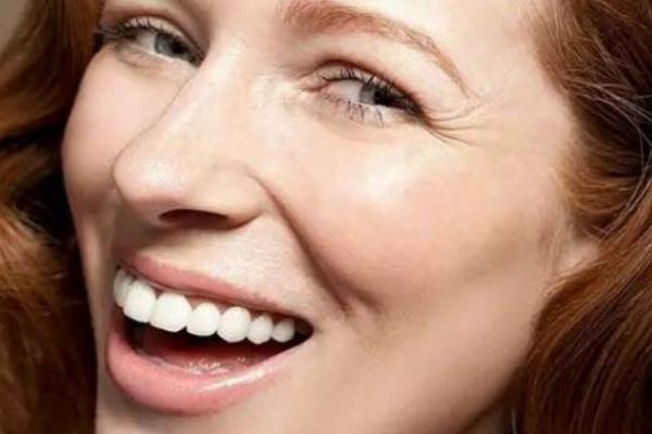 鱼尾纹是什么样子 鱼尾纹是桃花纹吗 鱼尾纹是什么样子 鱼尾纹是桃花纹吗