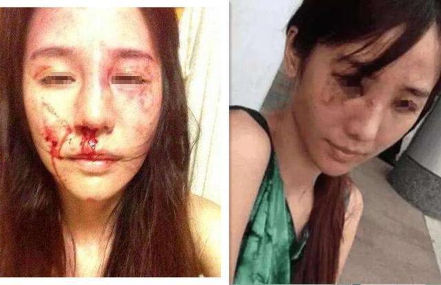 她抢了孙俪的角色一夜成名,后嫁入豪门被家暴才27岁就去世