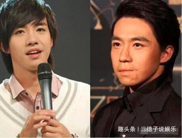 俞灏明自曝烧伤后第一个探望他的人,这辈子都不能忘