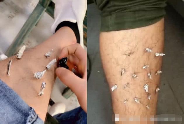 “锡纸烫”走红后，网友们“丧心病狂”，腿毛爱宠全不放过！