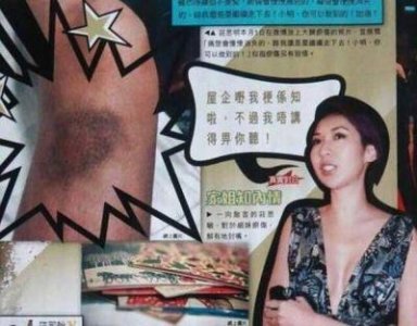 ​TVB实力女星遭遇流产之痛，去年与丈夫分道扬镳