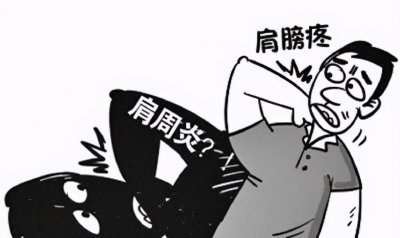 ​肩周炎的效穴—条口穴