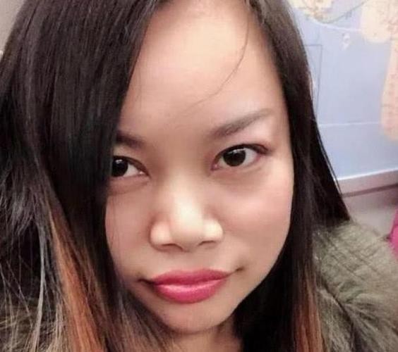 凤姐整容,凤姐整容被怼(凤姐现在照片) 凤姐整容,凤姐整容被怼(凤姐现在照片)