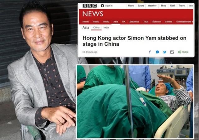 任达华被刺伤现场安保（多家海外媒体报道任达华被伤事件）(2)