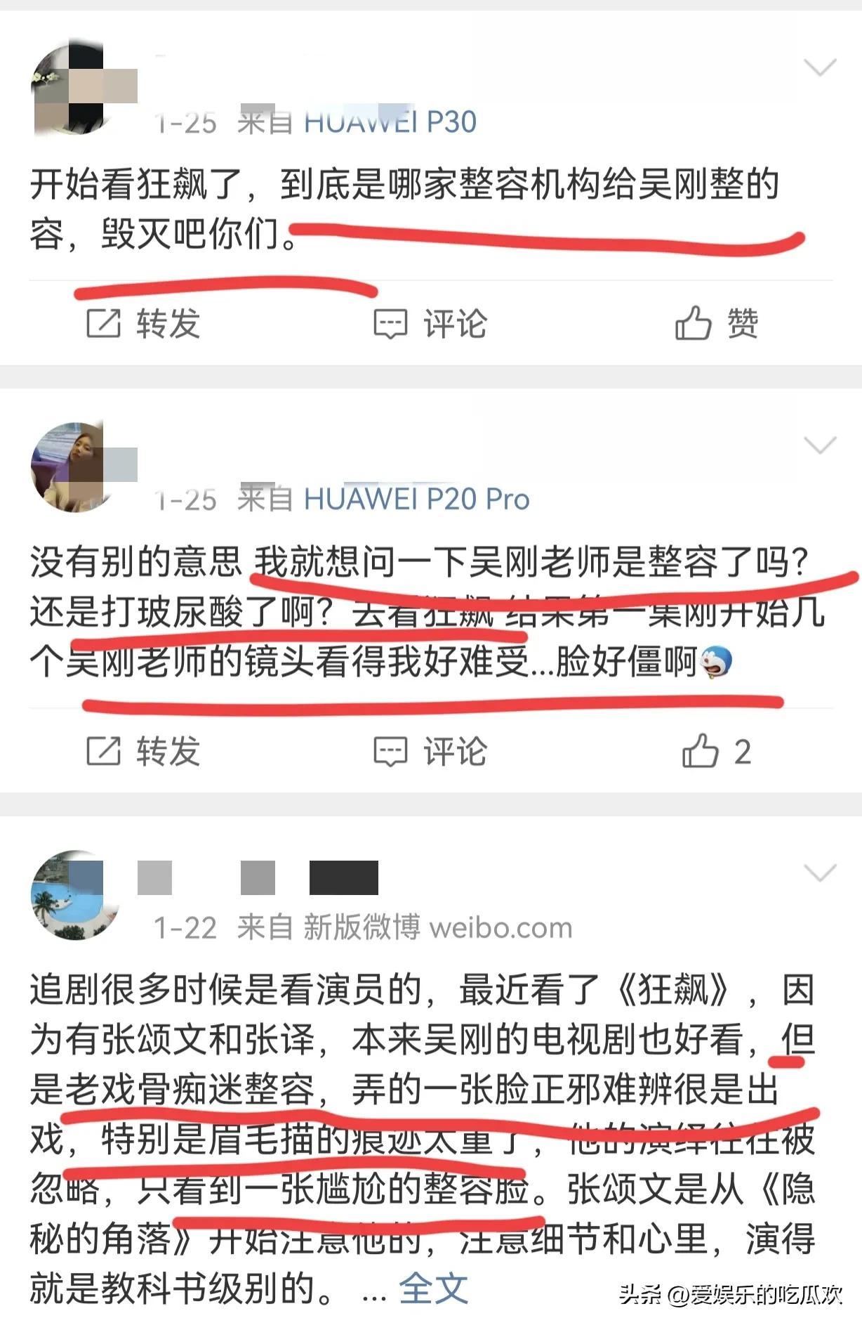 吴刚整容终于真相大白,原来脸肿不是因为打了玻尿酸,而是太敬业