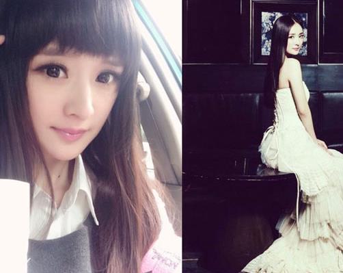 陈丹婷整容,丁亦昕 陈丹婷整容,丁亦昕