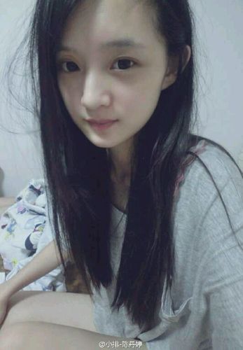 陈丹婷整容,丁亦昕 陈丹婷整容,丁亦昕