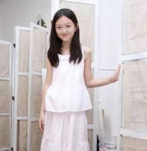 ​王菲女儿李嫣近照，兔唇明显改善，但鼻子略显奇特