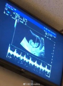 ​谢天华老婆怀二胎 晒宝宝B超照，网友：看你的电影长大