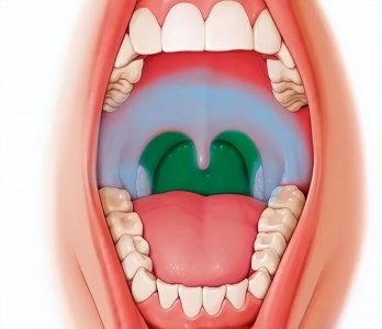 ​欧阳医生：疱疹性咽峡炎真的那么可怕吗？中医教你预防和治疗