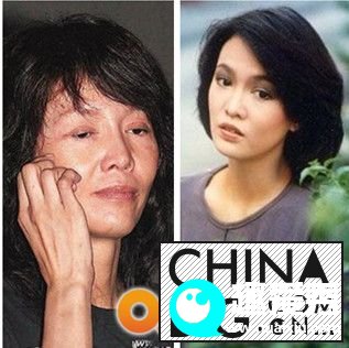 郑裕玲整容照片吓死人 郑裕玲整容前后对比照 郑裕玲资料